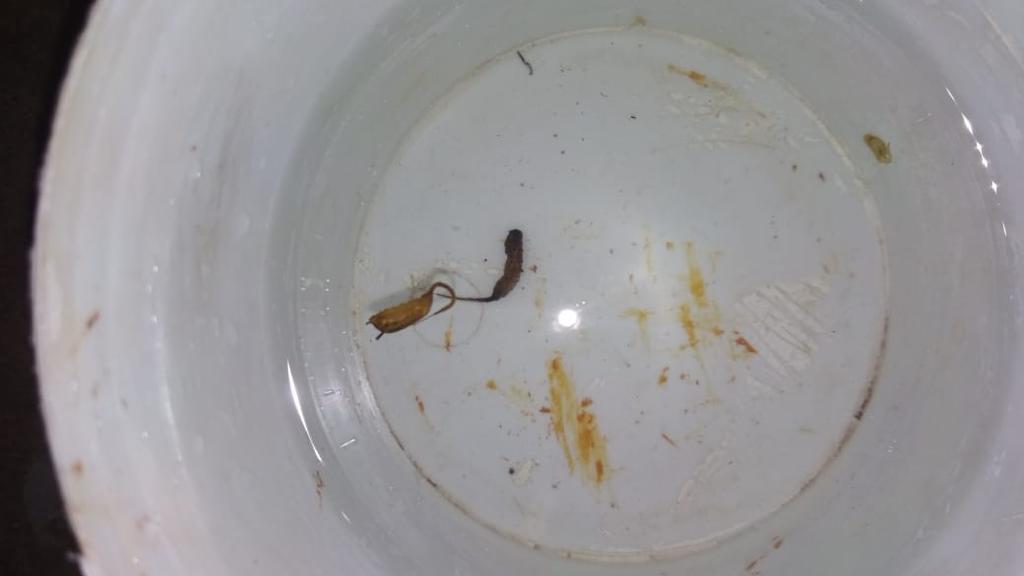 'Worm Water' in some areas of Vadodara